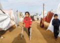 الأردن يطلق مبادرة لتركيب أطراف اصطناعية لمصابي غزة